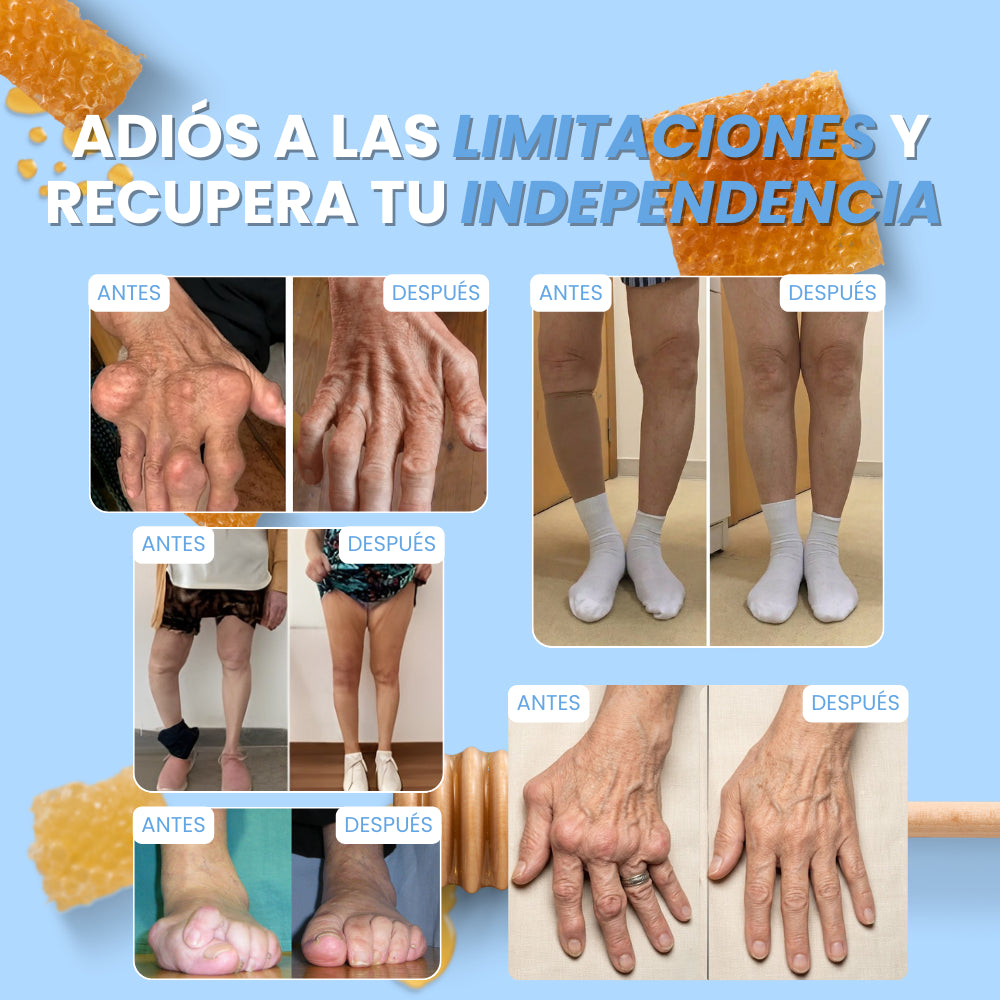 BeeFit Skin™ | DILE ADIÓS AL DOLOR Y LA RIGIDEZ Y VUELVE A VIVIR SIN LÍMITES EN SOLO 15 DÍAS
