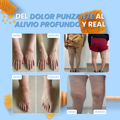BeeFit Skin™ | DILE ADIÓS AL DOLOR Y LA RIGIDEZ Y VUELVE A VIVIR SIN LÍMITES EN SOLO 15 DÍAS