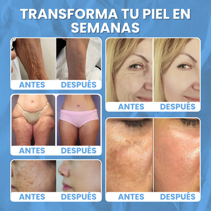 BeeFit Skin™ | LA CREMA QUE AYUDA A QUE TU PIEL LUZCA MÁS FIRME, SUAVE Y REJUVENECIDA DE FORMA NATURAL