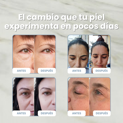 DragoSkin™ — Crema Antiedad Regeneradora con Sangre de Dragón