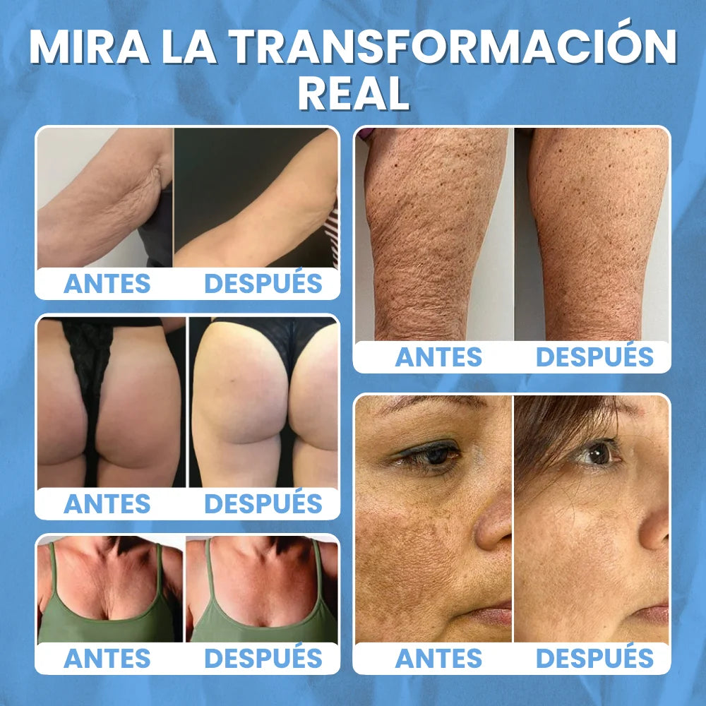 BeeFit Skin™ | LA CREMA QUE AYUDA A QUE TU PIEL LUZCA MÁS FIRME, SUAVE Y REJUVENECIDA DE FORMA NATURAL