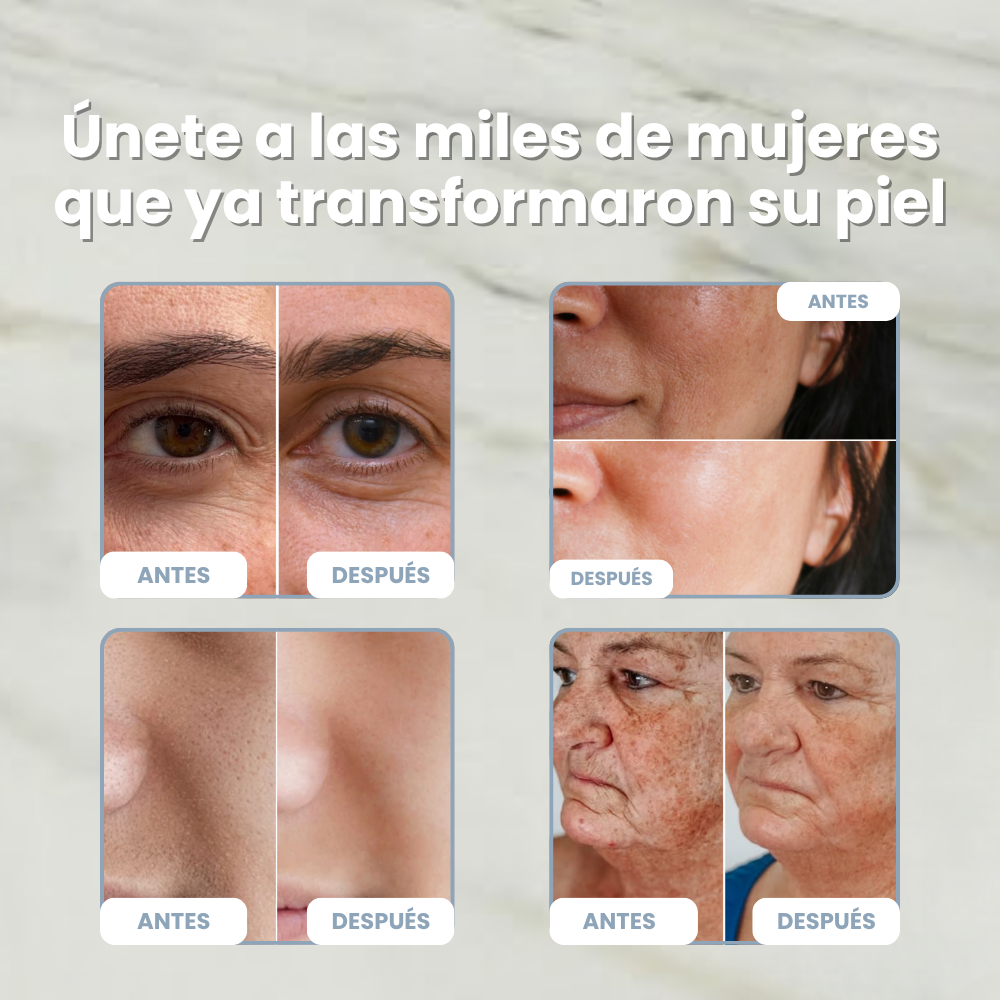 DragoSkin™ — Crema Antiedad Regeneradora con Sangre de Dragón