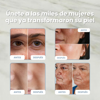 DragoSkin™ — Crema Antiedad Regeneradora con Sangre de Dragón