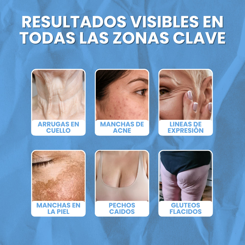 BeeFit Skin™ | LA CREMA QUE AYUDA A QUE TU PIEL LUZCA MÁS FIRME, SUAVE Y REJUVENECIDA DE FORMA NATURAL