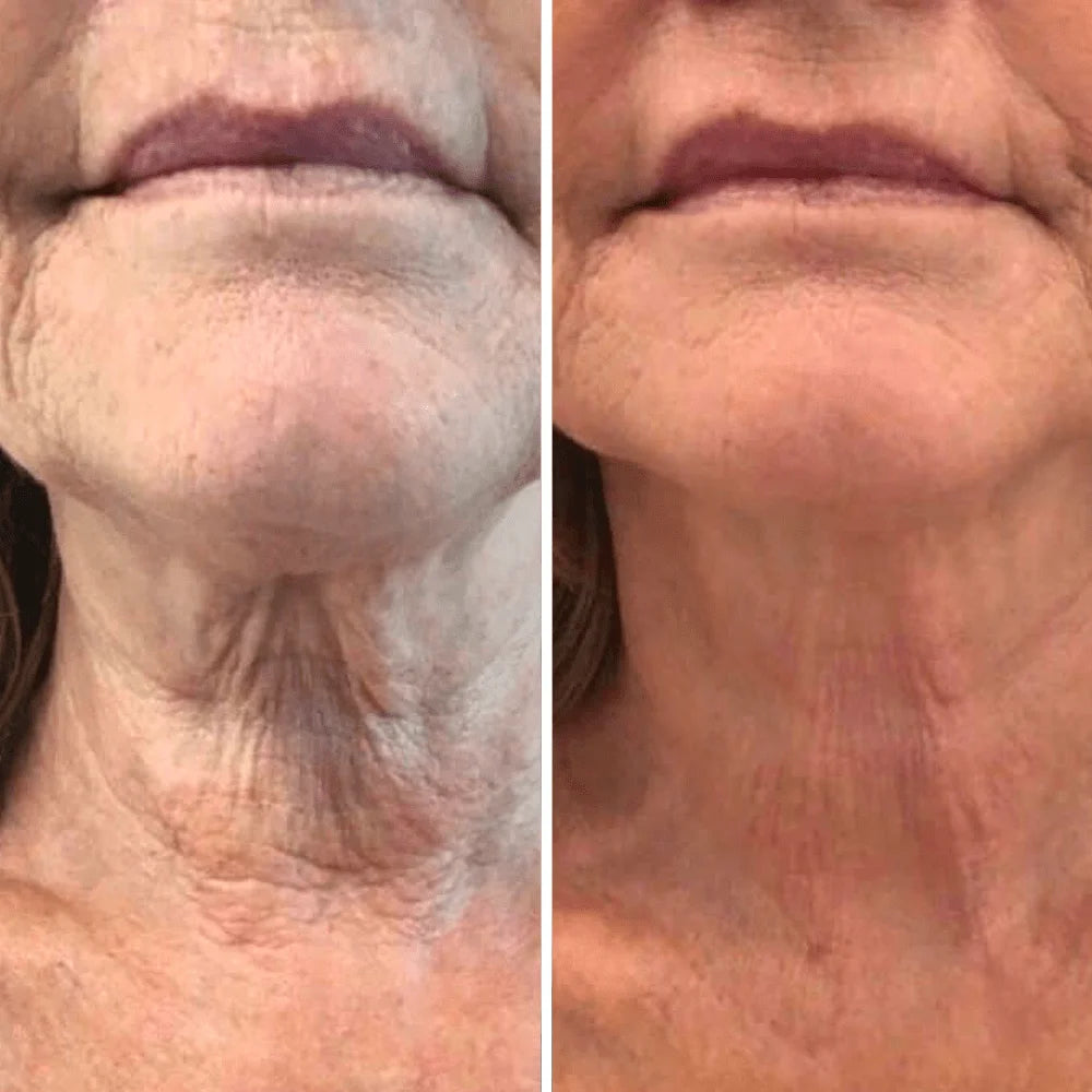 Neck Sculpt - Crema Reafirmante de Cuello con Masajeador 3D Anti-Edad