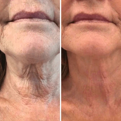 Neck Sculpt - Crema Reafirmante de Cuello con Masajeador 3D Anti-Edad