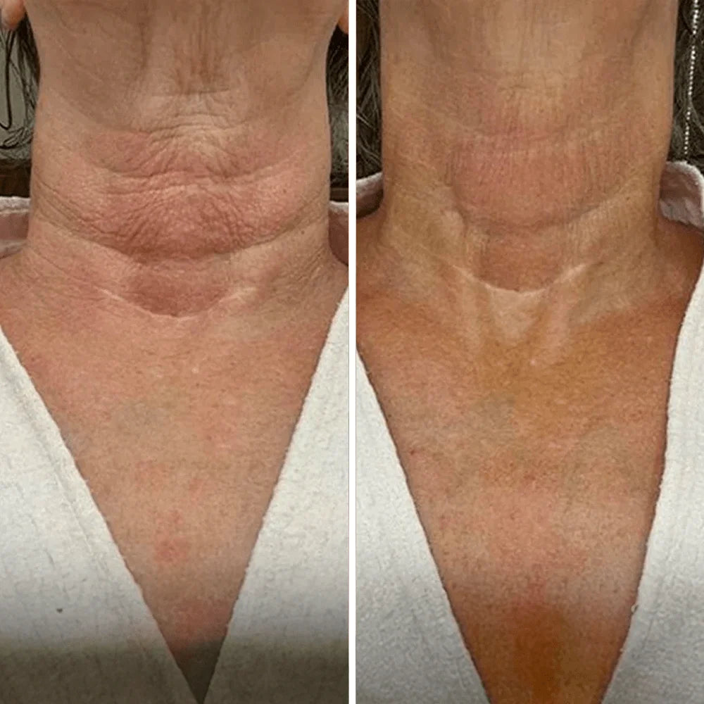 "Neck Sculpt - Crema Reafirmante de Cuello con Masajeador 3D Anti-Edad"