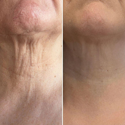 Neck Sculpt - Crema Reafirmante de Cuello con Masajeador 3D Anti-Edad